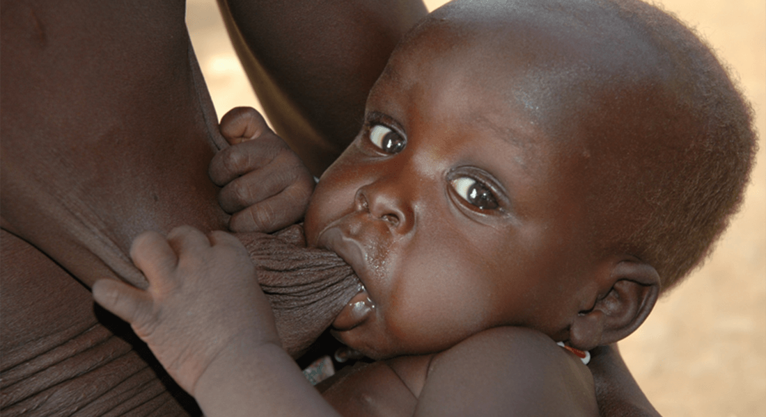 Mothers to children with acute malnutrition often do not have much milk for the child. Credit: Christian Fabiansen